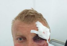 Lider al Pro România, bătut de hoți