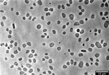 Israelul anunţă că a inventat plastic din alge marine