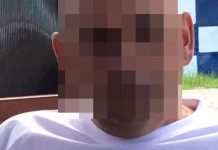 Un cunoscut PRIMAR din Gorj a suferit un accident „casnic”! Edilul a avut nevoie de zece copci!