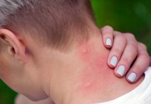 Cinci specii noi de țănțari în România. Ce boli prezintă ele