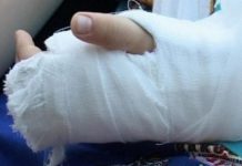 Atacați de câinii din cariera minieră