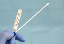 Zeci de teste trimise, din Gorj, în laboratoare din țară