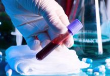 50 de noi cazuri de COVID-19, în Gorj