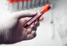 Gorj: 63 de cazuri noi de coronavirus Județul Gorj înregistrează încă 63 de cazuri noi de coronavirus și 803 persoane sunt în carantină la domiciliu/locația declarată