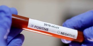 Au fost înregistrate 2.069 de cazuri noi de persoane infectate cu SARS – CoV - 2 (COVID – 19), acestea fiind cazuri care nu au mai avut anterior un test pozitiv