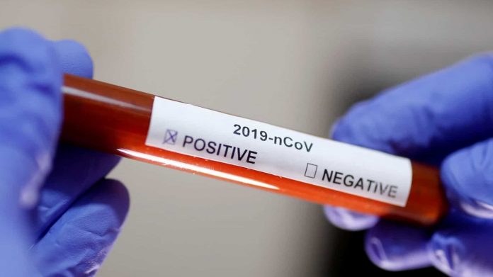 Au fost înregistrate 2.069 de cazuri noi de persoane infectate cu SARS – CoV - 2 (COVID – 19), acestea fiind cazuri care nu au mai avut anterior un test pozitiv