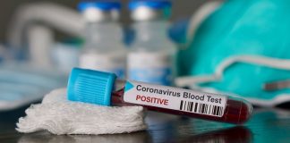 Gorj: Femeie, de 37 de ani, moartă de coronavirus