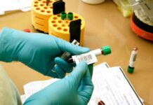 15:51 Analize medicale gratuite prin CAS Gorj la Spitalul Județean de Urgență Târgu-Jiu